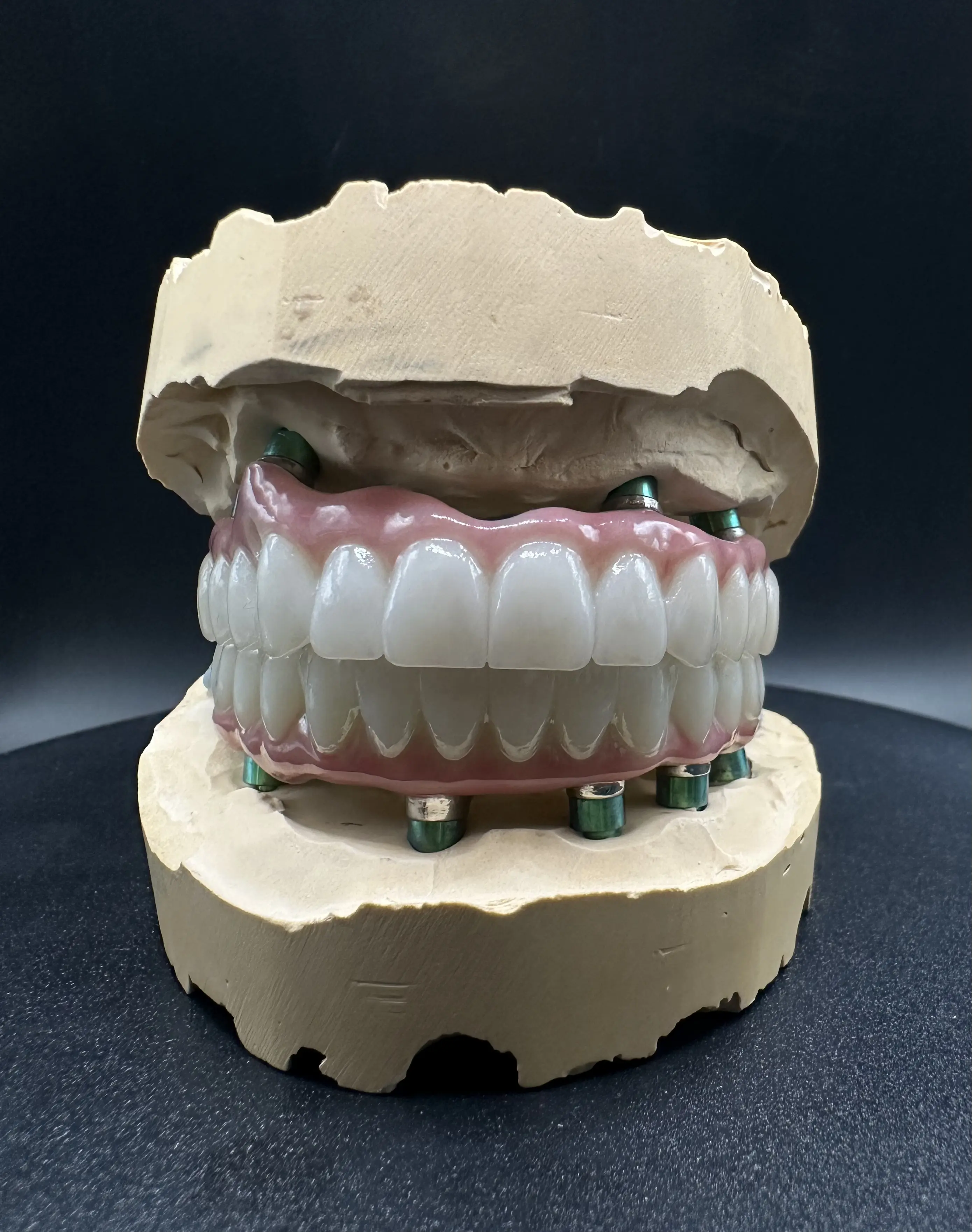 3D сканирование челюсти